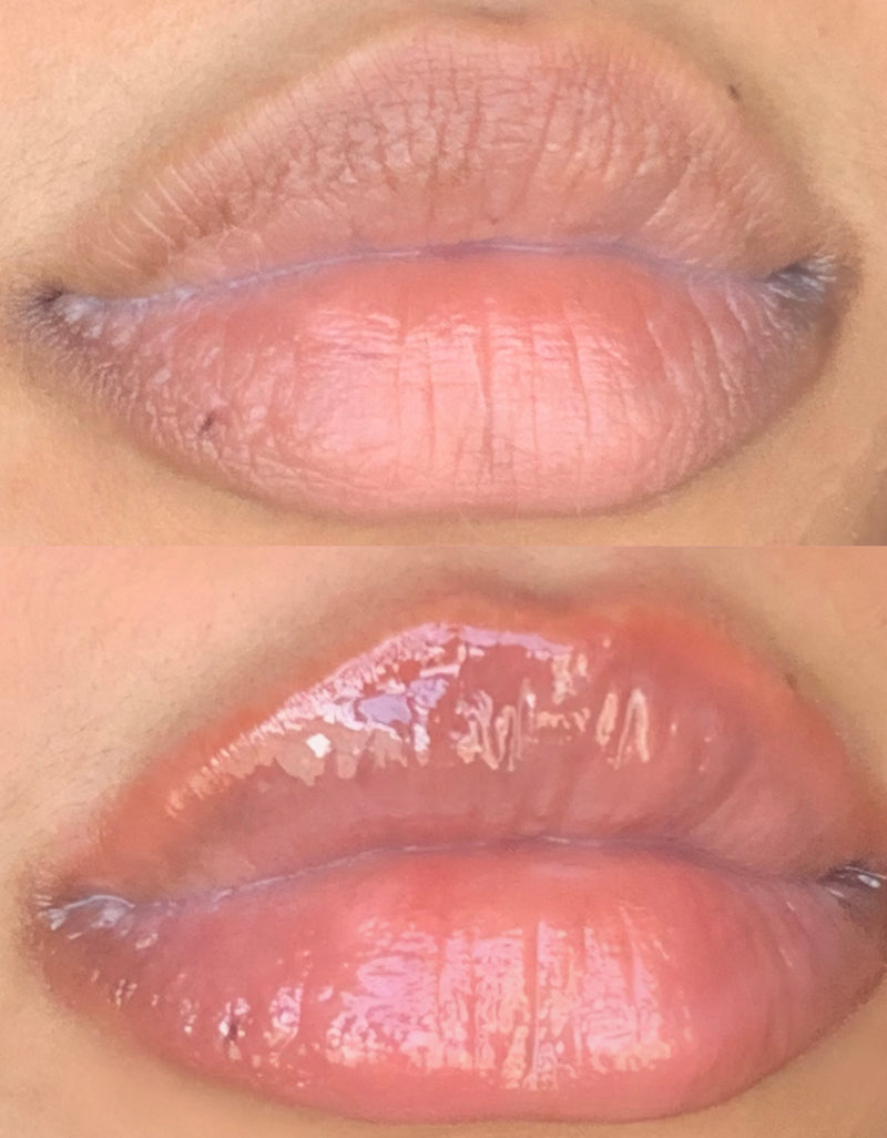 Extreme lip plumper